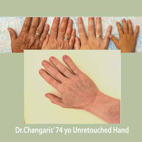 Ceela Naturals CLA Based